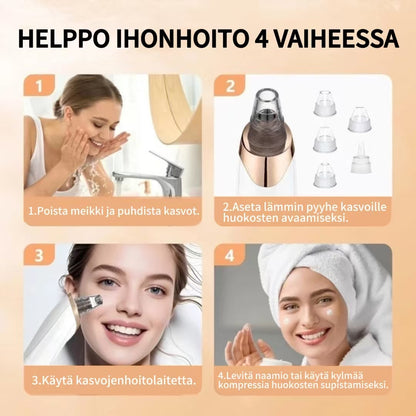 Ammattilaiskäyttöön tarkoitettu mustapäiden poistaja