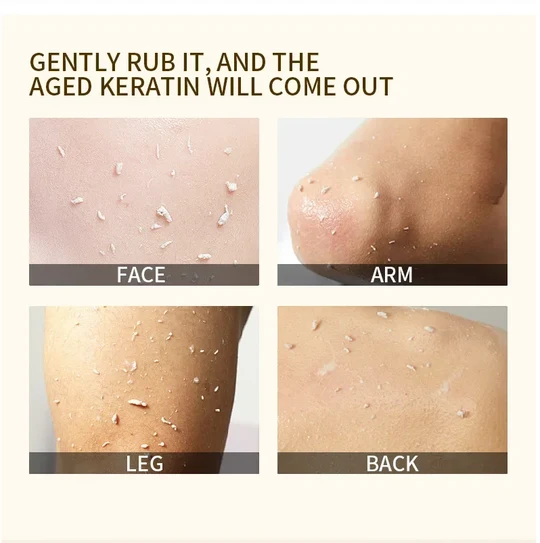 🍊 Tijdelijke aanbieding: 1+1 gratis (Koop 1, krijg 1 gratis)! Sinaasappel peeling gel – verwijdert op milde wijze dode huidcellen ✨