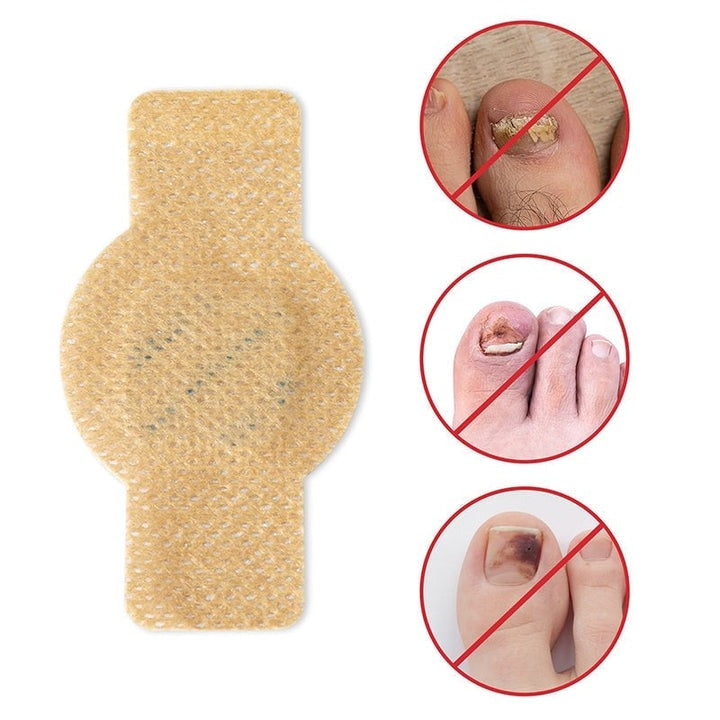 FungalPatch - Intensieve Nagelverzorging Set - Zelfklevende Schimmelwerende Pleisters