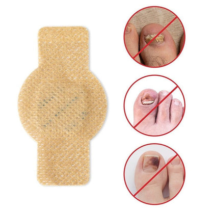 FungalPatch - Intensieve Nagelverzorging Set - Zelfklevende Schimmelwerende Pleisters