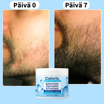 Anti-hilse hiusnaamio