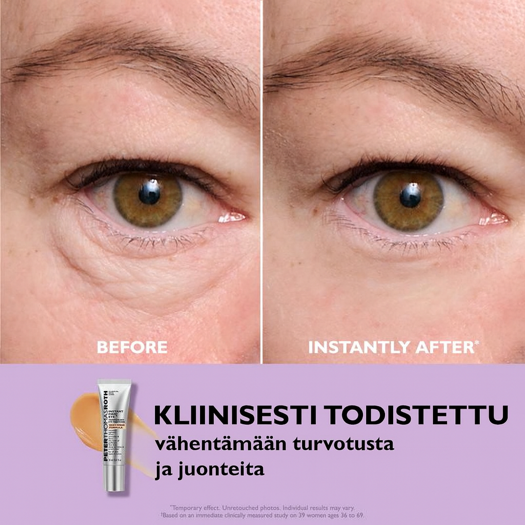 Peter Thomas Roth Instant FirmX – Välitön, tilapäinen silmänympärysihon kiinteyttäjä