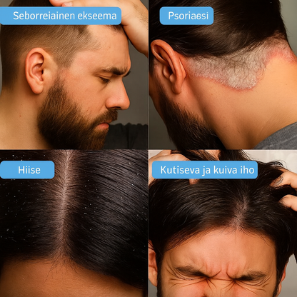 Anti-hilse hiusnaamio