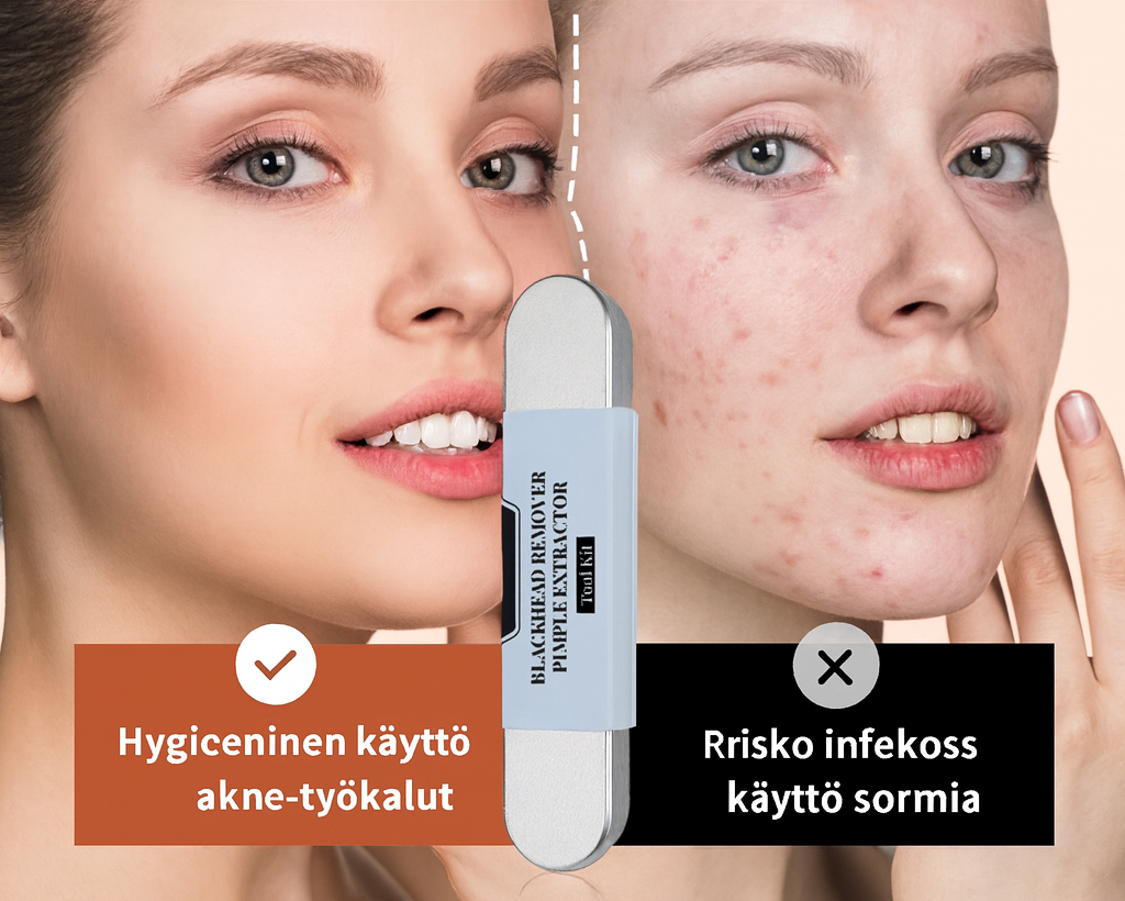 Ruostumattomasta teräksestä valmistettu mustapäiden poistovälinepakkaus
