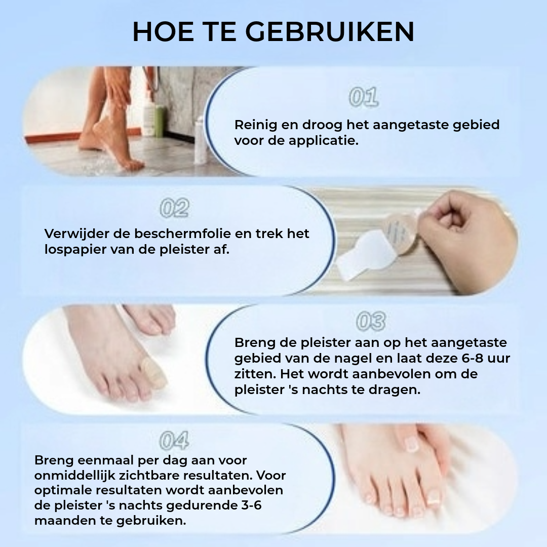 FungalPatch - Intensieve Nagelverzorging Set - Zelfklevende Schimmelwerende Pleisters