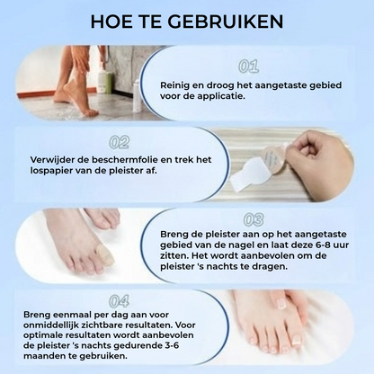 FungalPatch - Intensieve Nagelverzorging Set - Zelfklevende Schimmelwerende Pleisters