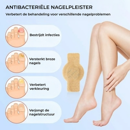 FungalPatch - Intensieve Nagelverzorging Set - Zelfklevende Schimmelwerende Pleisters