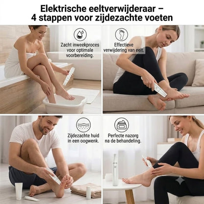 Elektrische eeltverwijderaar