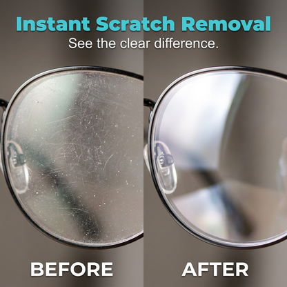 🔥 Nu 50% korting! 🎁 Professionele reparatie- en reinigingsspray voor brillenglazen